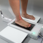 Is 3D Scanning For Orthotics Taking Over Traditional Casting?