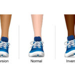 What is inversion and eversion?