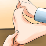 Beware of Plantar Fasciitis