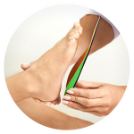 How to get orthotics