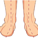Top Five Foot Problems: Symptoms And Treatment