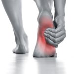 Heel Pain Plantar Fasciitis