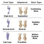 foot type