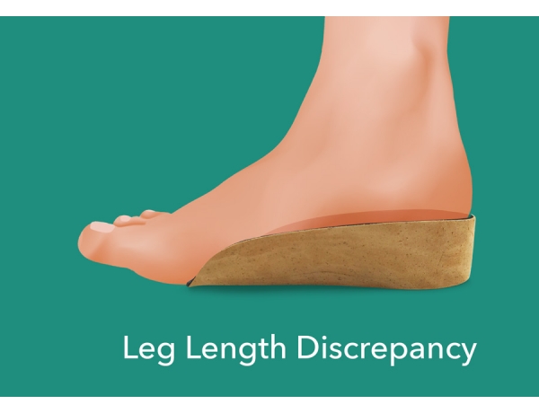 shoe inserts for leg length discrepancy
