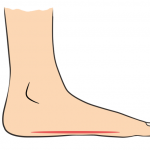 flat feet