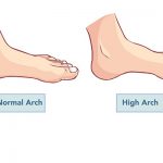 Vector - vector illustration of a flat and normal feet