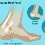 Common Foot Diseases