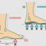 What is an Orthotic insoles
