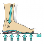 What is an Orthotic insoles