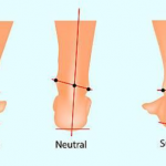 Pronation and Supination of the Foot