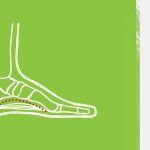 High Arches Explained