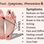 diabetic-foot