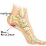 plantar fascia foot
