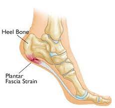 plantar fascia foot