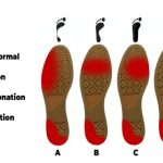supination-severity-diagram