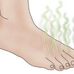 How to Cure Foot Odor