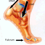 Take Off the Heightening Insole