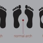 Gait Assessment