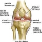 Patellofemoral Pain