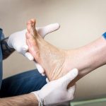 sesamoiditis