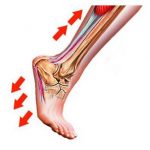 Causes of Heel Pain (I)
