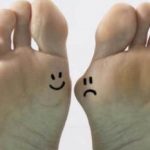 How to Choose Shoes for Hallux Valgus