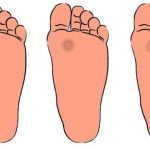 How to Distinguish Podiatric Problems?