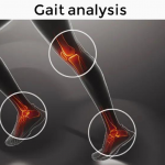 gait-correction