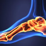 Relieve Mild Heel Pain Today with These 7 Tips