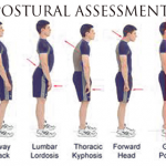 Posture Analysis
