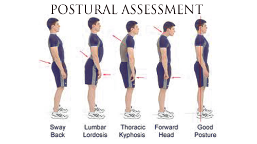 Posture Analysis
