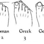 which-foot-type-are-you-egyptian-roman-greek