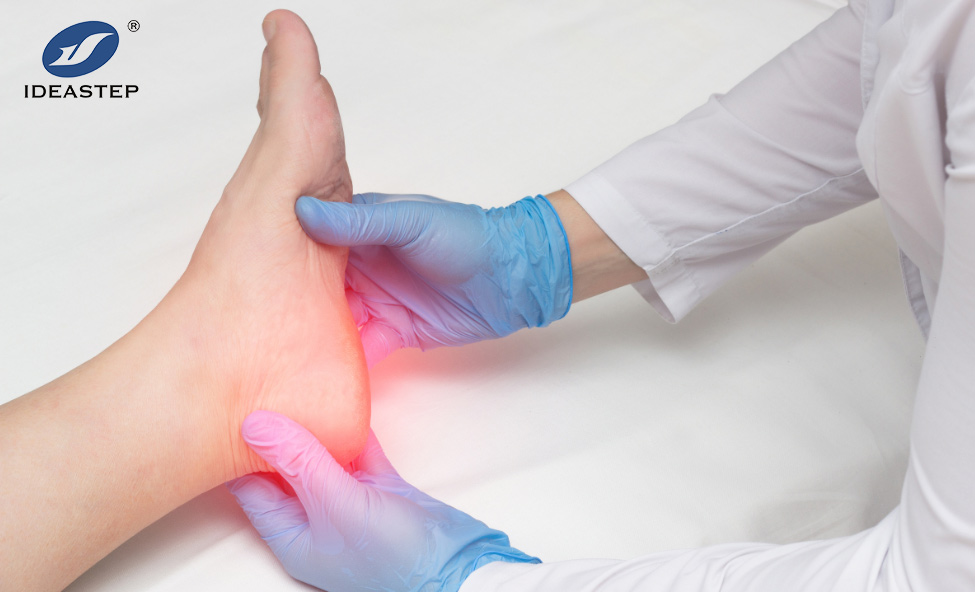Congenital Clubfoot