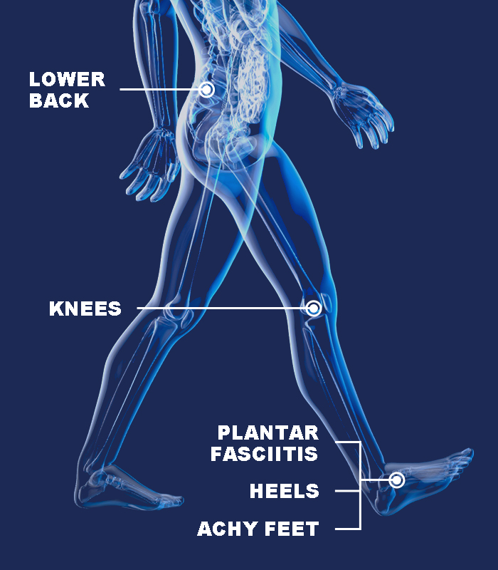 Foot Problems - Plantar Fasciitis