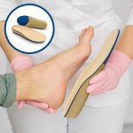 How to customize orthotic insoles