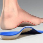 Do insoles help fallen arches