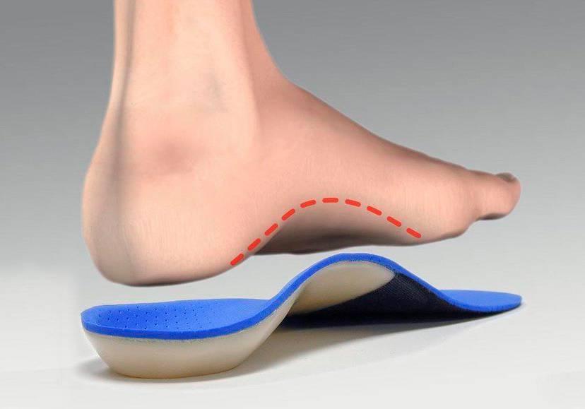 Do insoles help fallen arches