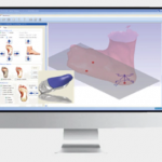 3D-printed insoles
