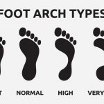 How to determine if it is flat feet