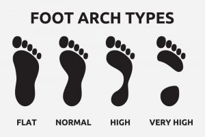 How to determine if it is flat feet