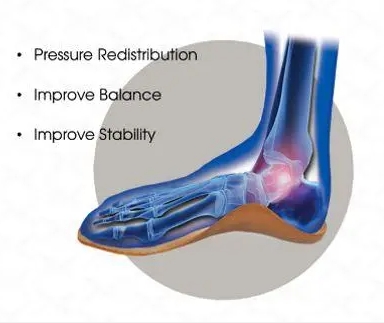 the mechanism of action of Orthopedic insoles