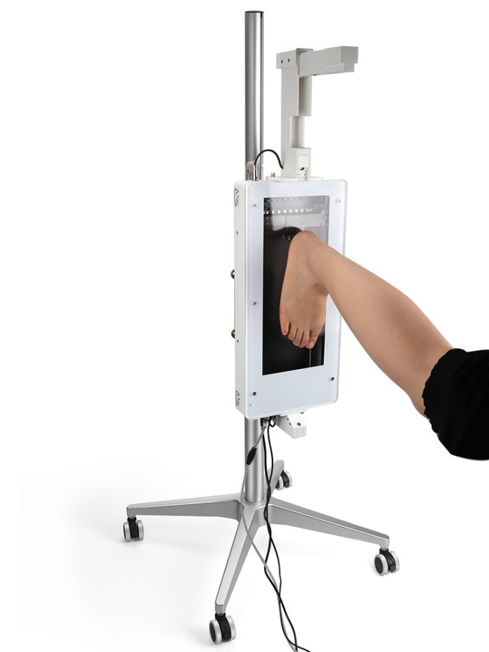 XSOL 3D Laser Foot Plantar Scanner