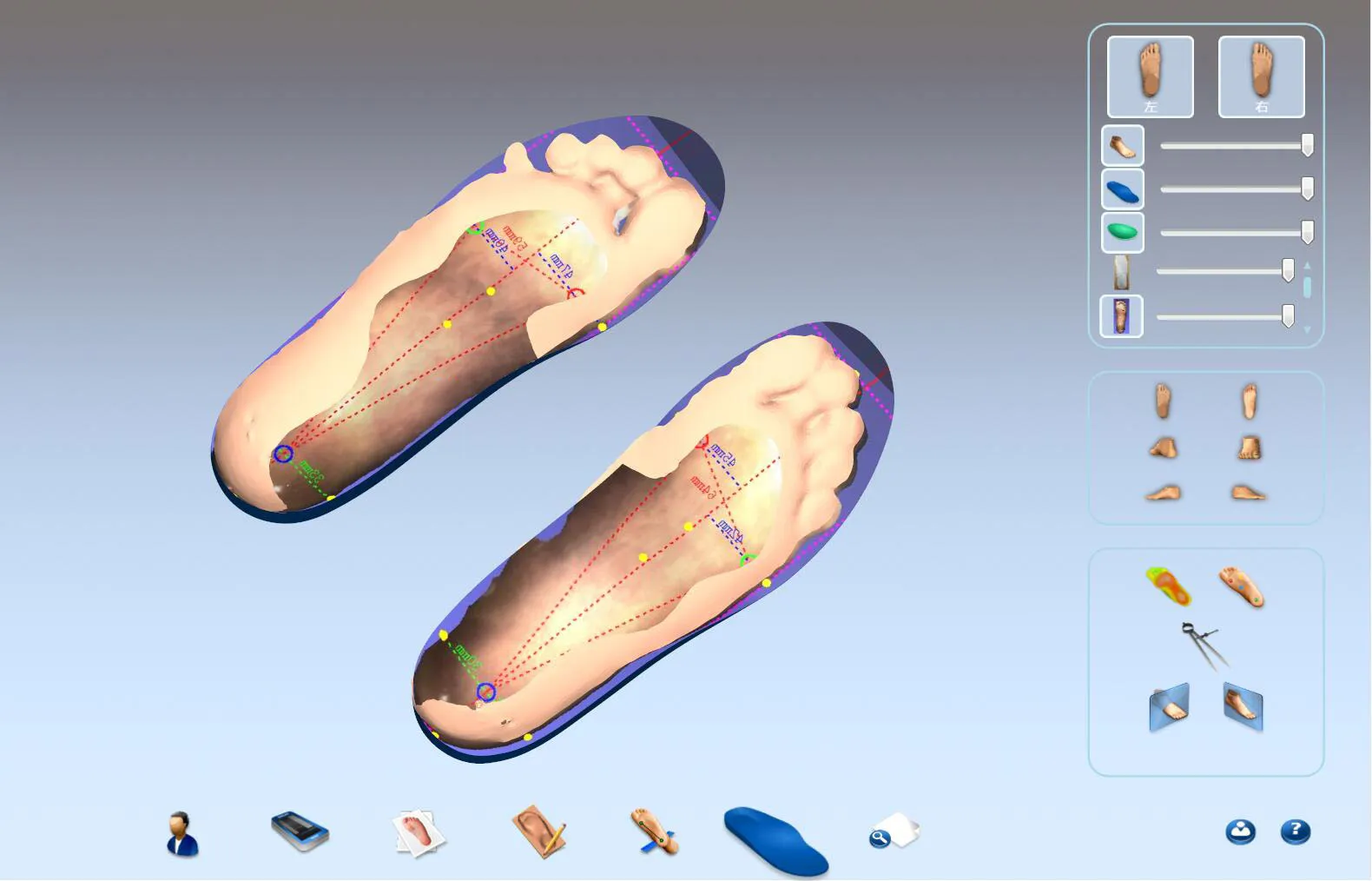 custom insoles