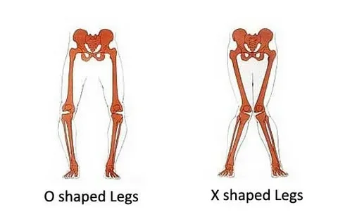 legs shape