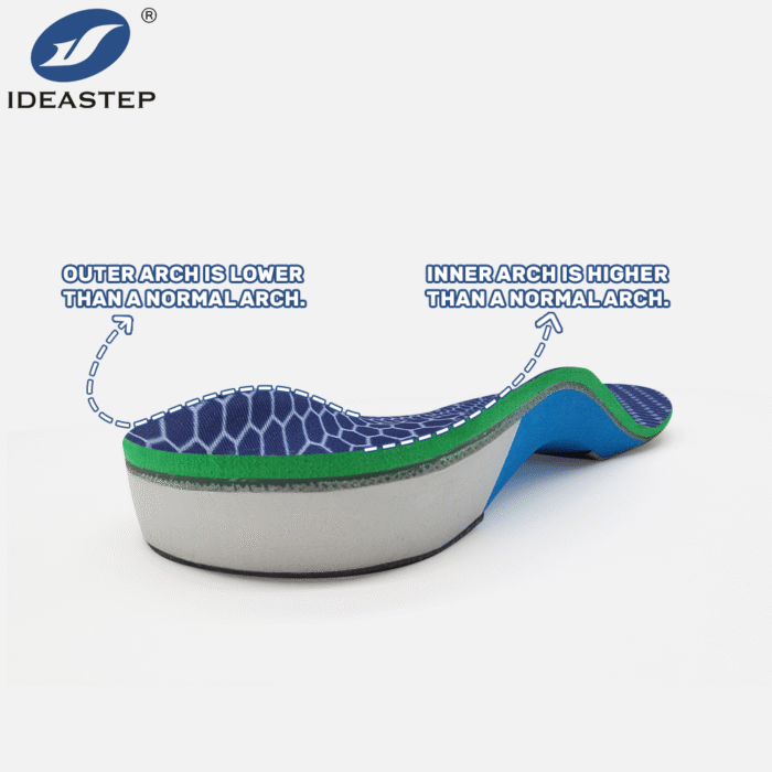 Semi‑Custom Orthotic Insoles for Pronation Correction | Foot Alignment ...