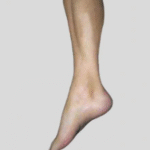 Orthopedic Insoles for Flat Feet Focused on Alignment, Cushioning, and Daily Relief