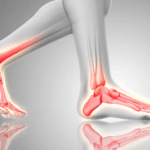 Supination Insoles for Better Foot Alignment and Pressure Relief