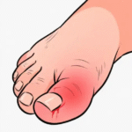 Best Insoles for Big Toe Arthritis: A B2B Buyer’s Guide for Wholesale Sourcing